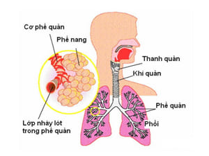 bai-thuoc-tri-ho-do-phe-am-hu