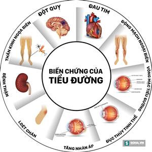 nhung-dau-hieu-nhan-viet-ban-mac-benh-tieu-duong