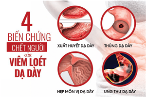 Viêm Loét Dạ Dày: Dấu Hiệu, Nguyên Nhân và Cách Điều Trị Tại Nhà Hiệu Quả